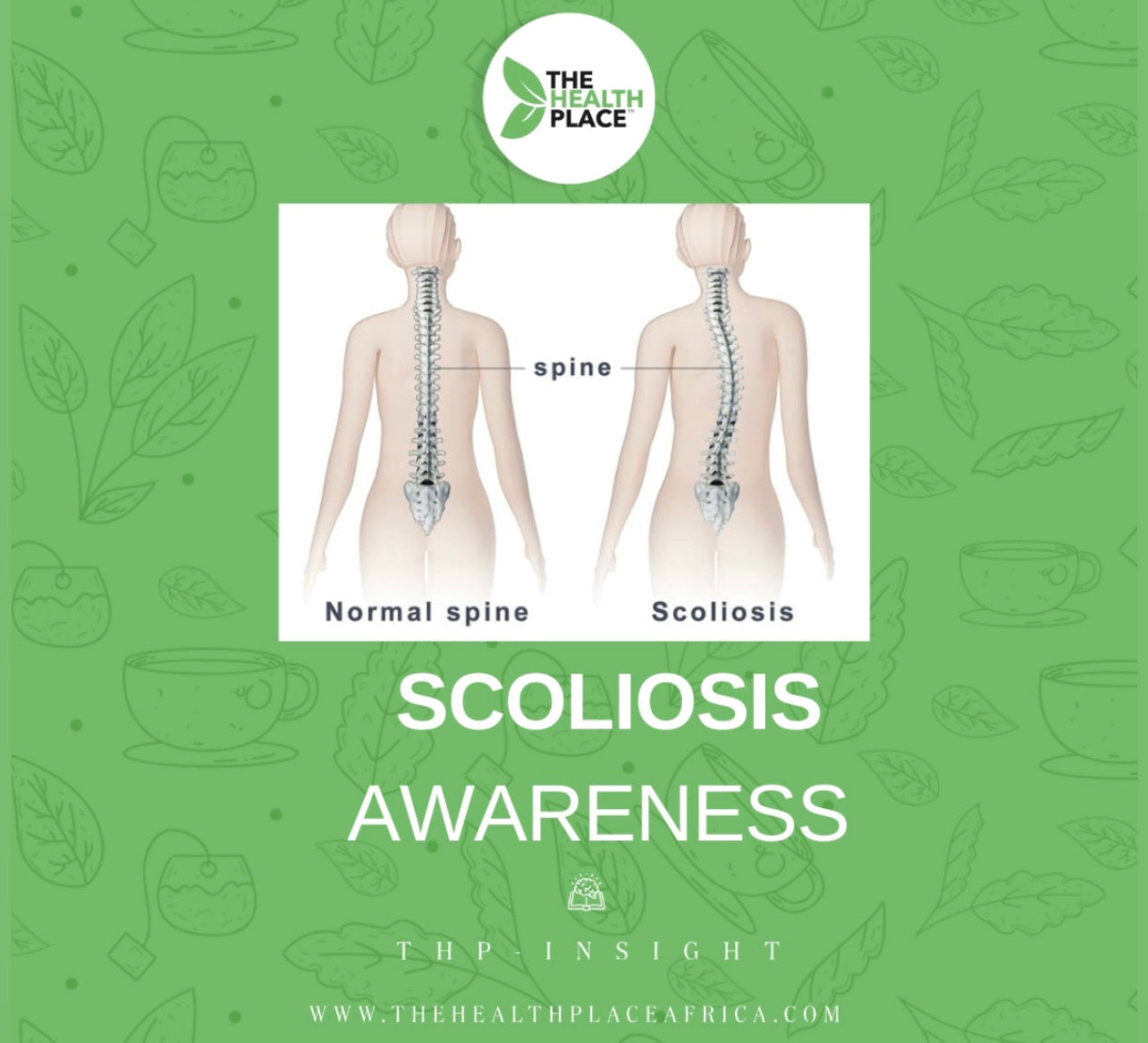 SCOLIOSIS AWARENESS