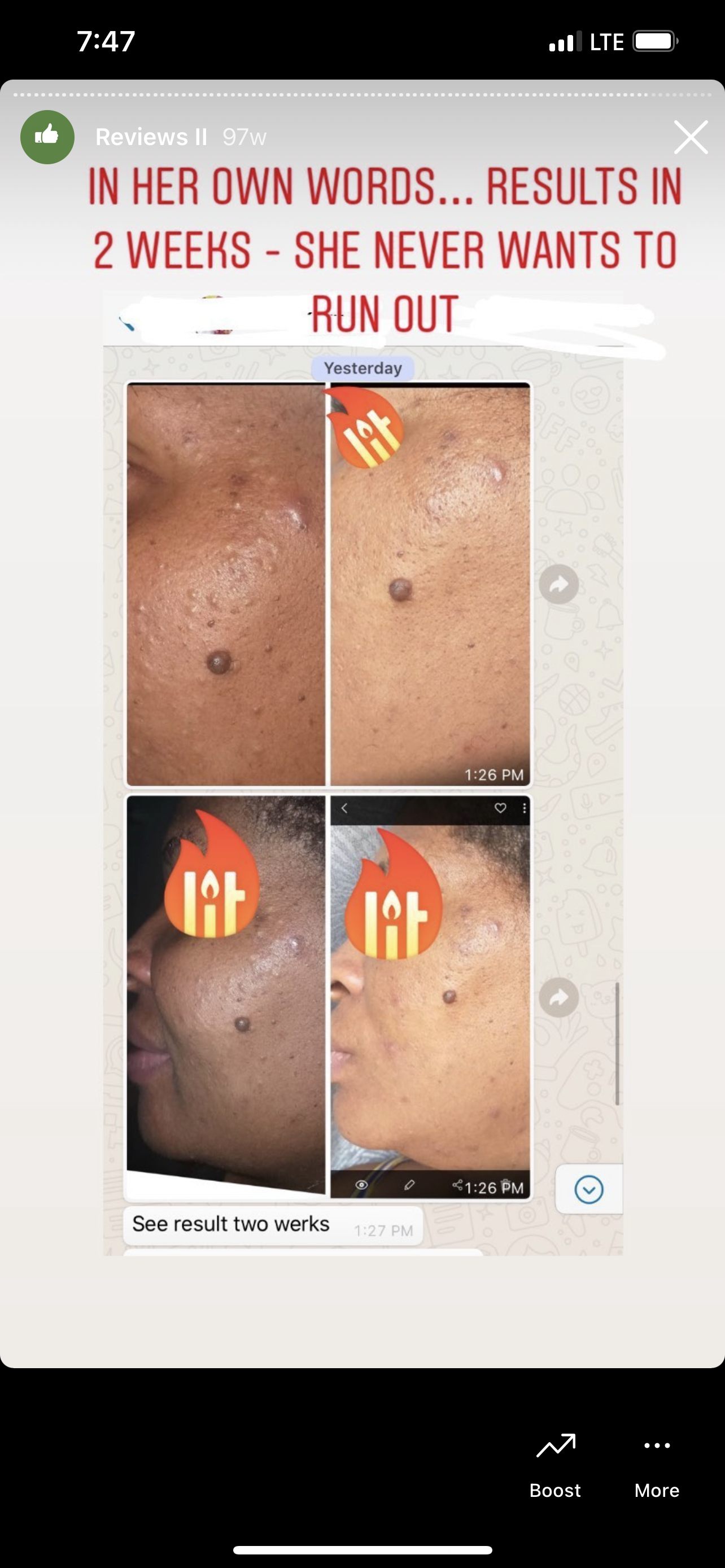 Skin Detox Acne Cleanse Herbal Mix - Choose Form