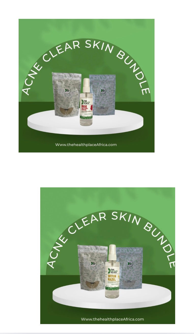 Acne Clear Skin Bundle- 100g Acne Skin Cleanse Powder + 120ml Rose Hydrosol or Witch Hazel+ 100g French Green Mask